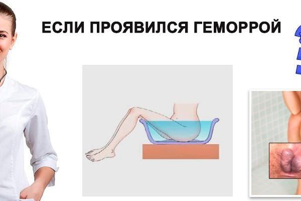 Забыл пароль от кракен